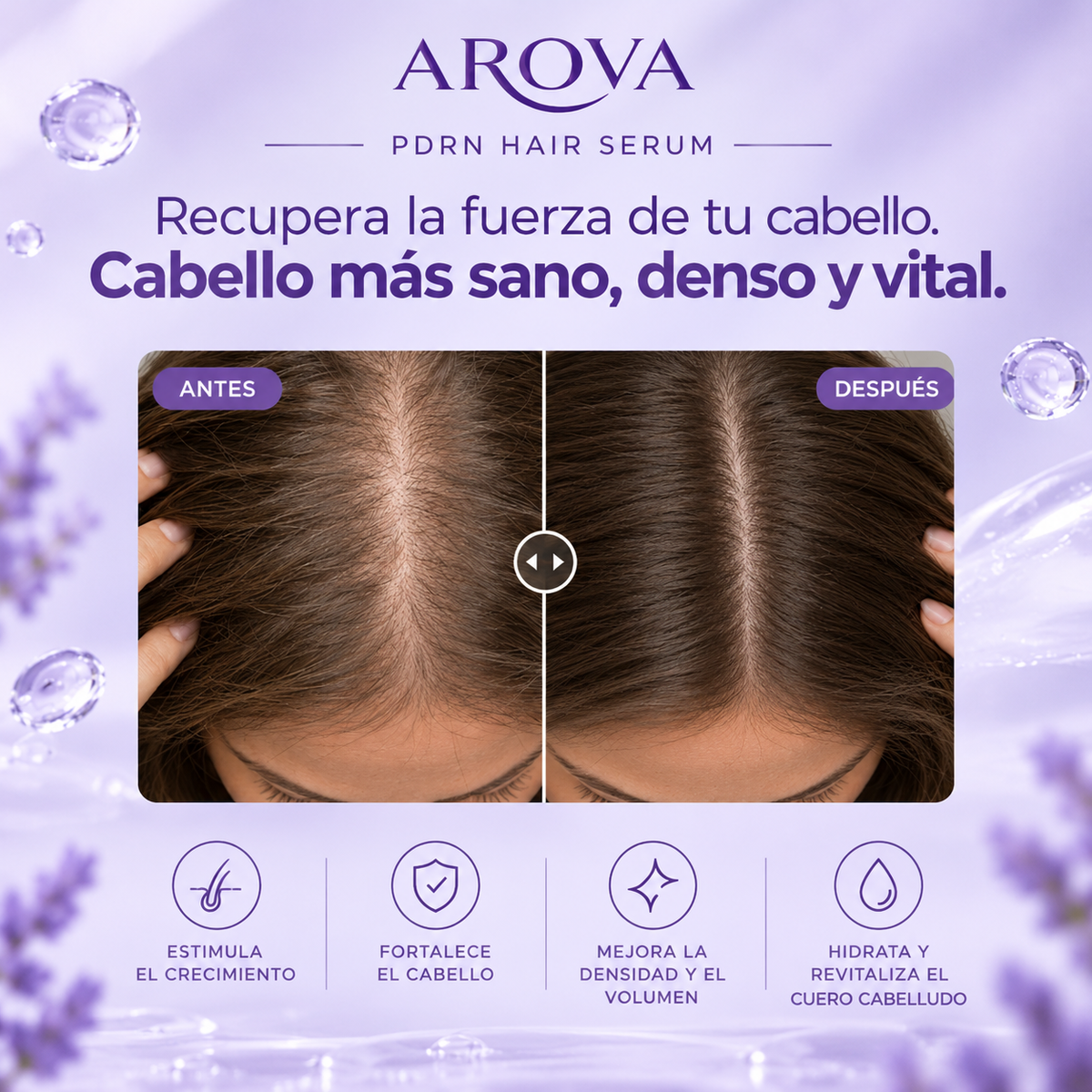 AROVA PDRN – Sérum Capilar con Aplicador de Precisión